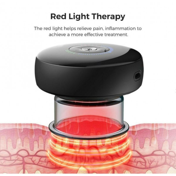 Aparat tip ventuza... 2